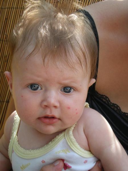 ral bol des moustiques !